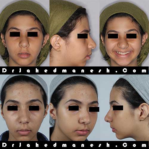ارتودنسی اولین معاینه ارتودنسی